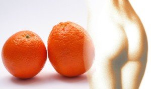 cellulite
